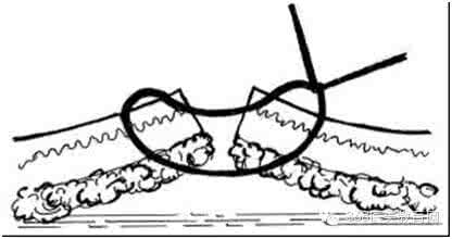 跟腱缝合方法图示 缝合技巧清晰图示