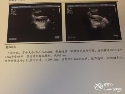 b超女宝 生下来是男宝 b超女宝 生下来是男宝 孕妈B超显示女宝,手术后发现是男胎,亲手葬送了儿子