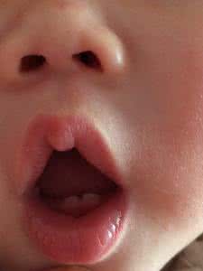 宝宝几个月长牙正常 宝宝几个月长牙?宝宝正常的长牙时间!