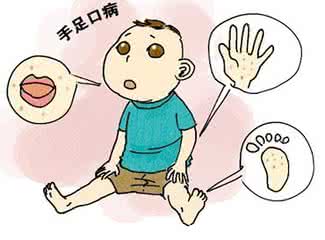 真假手足口病巧识别 手足口病真的就那么可怕吗