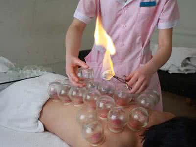 怀孕能不能拔罐 怀孕为什么不能拔罐？
