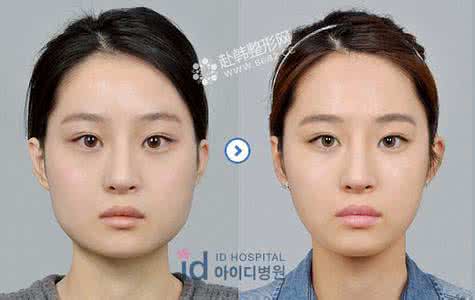 上海颌面整形价格 颌面整形 专家谈颌面整形的价格是多少