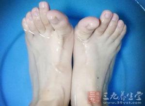 脚底交界痣 脚底有痣的人竟会一生交吉运