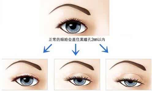 皮肤松弛怎样做双眼皮 预防眼皮松弛 怎样预防皮肤松弛？