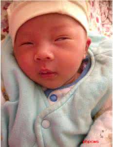 宝宝翻白眼怎么回事 宝宝爱白眼怎么回事?