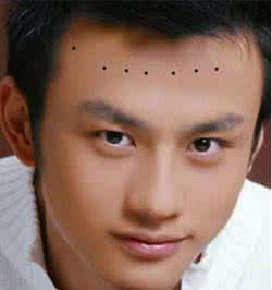 男人额头有痣代表什么 额头长痣代表什么?男人额头长痣好不好