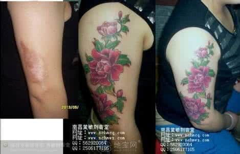 纹身遮盖疤痕忌讳 遮盖大面积黑色纹身 大面积疤痕怎么遮盖？