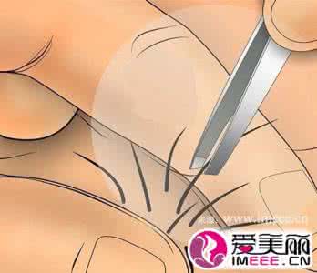怎么去除毛发 怎么去除家中的毛发