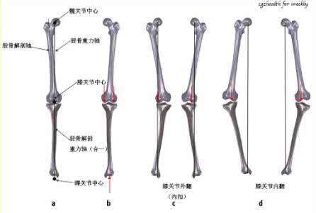 大象腿怎样快速的瘦腿 绝望腿型拯救术 大象腿速瘦五斤变小鸟腿
