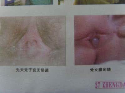 石女是什么样子的图片 石女是什么样子的图片 核桃的图片是什么样子呢