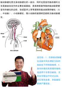 注射用尼麦角林 使用注射用尼麦角林后为什么总是上腹疼痛呢 需要中断治疗吗