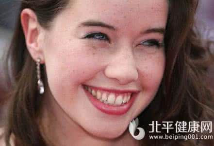 女人祛斑方法 能让女人脸上的斑离开好方法