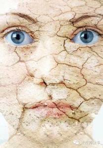 油性皮肤变成干性皮肤 皮肤干性油性 远离粗糙干燥 油性肌和干性肌应区分洗脸