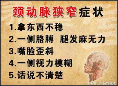 冠心病的相关健康知识 祖传秘方：冠心病仙方，胜似仙丹【健康知识】
