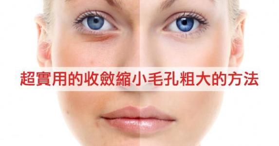 鼻子毛孔粗大能修复吗 如何修复鼻子毛孔粗大 如何预防鼻子毛孔粗大
