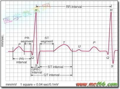 常见异常心电图 心电图基本知识及常见异常心电图表现特点