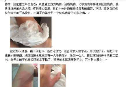 烧伤科医生招聘 烧伤科美女医生直播自己烫伤急救 网友：长知识了！