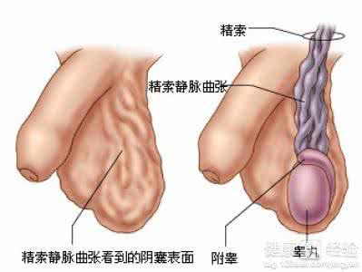 男性睾丸痛是什么原因 男性睾丸痛是什么原因 男性睾丸的日常护理