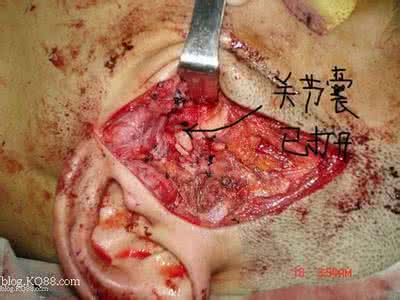 蛆虫养成红色 【内部-禁分享】红色蛆虫标本 李德生 | 冬川豆