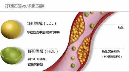 高胆固醇怎样治疗 降低胆固醇的方法 降低胆固醇的食物