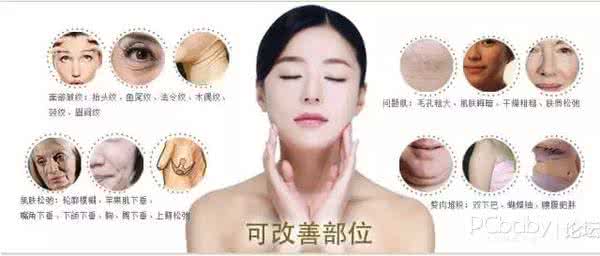 面部埋线提升注意事项 面部埋线后注意事项 面部埋线的原理、优势和术后注意事项