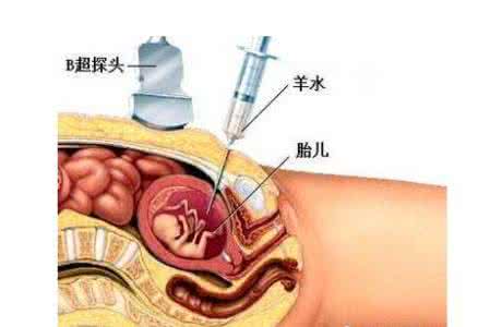 羊水破了怎么办 羊水过早破了怎么办