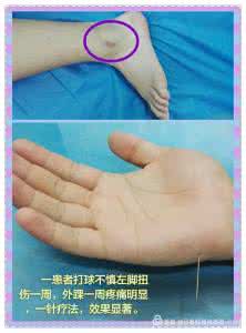 马春晖小六针讲解 马春晖小六合一针疗法