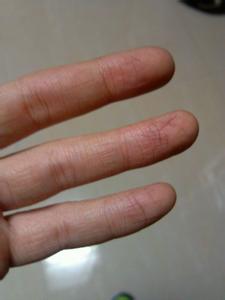 冬天手开裂涂什么好 冬天手开裂怎么办