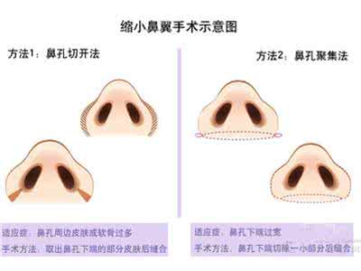 大鼻头如何缩小 如何缩小鼻头 大鼻头怎么缩小