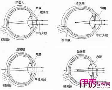 散光与近视区别 近视与散光有区别吗?