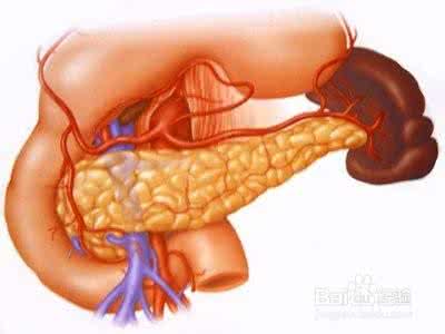 慢性胰腺炎 慢性胰腺炎 它有哪些预防措施