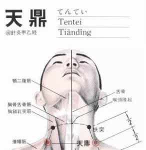 理气化痰 【每日一穴】天鼎穴：理气化痰、清咽利膈