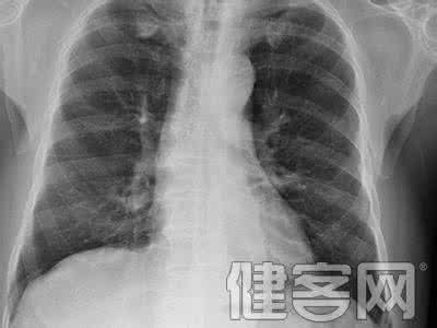 肺鳞癌术后如何防复发 肺癌复发 肺癌复发该如何治疗