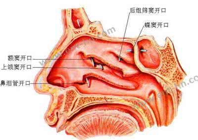 鼻炎怎么治能除根 根治鼻炎