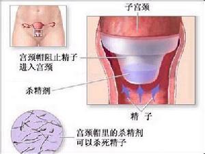 图解:精子射入阴道进入子宫全经历