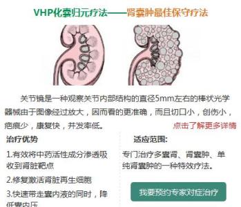 多囊肾最新治疗方法 多囊肾的治疗 九大方法治多囊肾