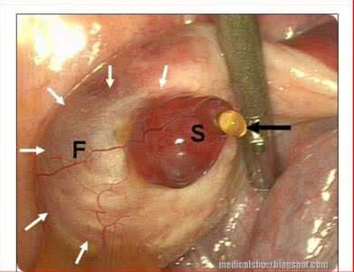排卵痛多久卵子排出 卵子什么时候排出?女性吃什么利于排卵?