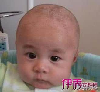 新生儿前囟门正常值 新生儿前囟门正常值 新生儿头睡偏了,谁之过?谈谈囟门二三事