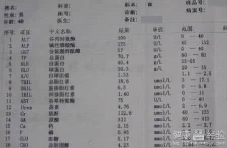 肝囊肿吃什么食物好 肝囊肿最佳治疗方法