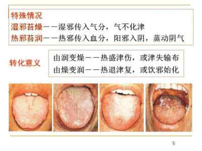 舌诊 【转载】【图解健康】跟教授学舌诊，很实用的舌诊知识！