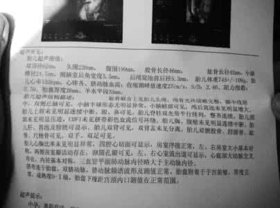 产检做几次b超 产检要做几次b超 产检做几次b超检查
