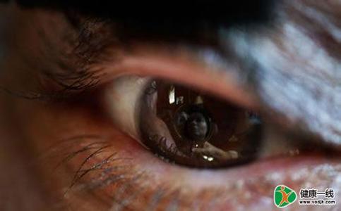 眼睛充血是什么原因 眼睛充血是什么原因 中医帮你治疗眼睛充血