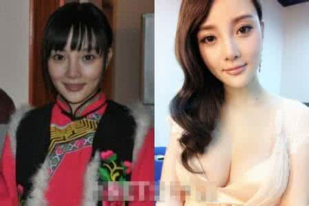 李小璐女儿丑 整容失败 郑爽李小璐萧蔷整容需谨慎明星整容失败，丑不堪言