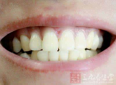 牙齿上有个小黑洞 牙齿上的小黑洞千万不能放任不管