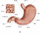 急性胃粘膜病变 急性胃粘膜病变 什么是急性胃粘膜病变