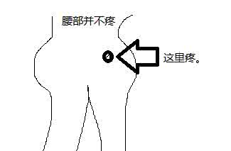腰肩盘突出 腰肩盘突出 腰肩盘突出的致病因素