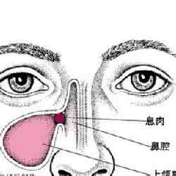 形容消失的无影无踪 多管齐下，让鼻炎消失无踪2