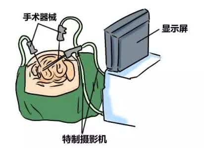 剖宫产后还能顺产吗 风信子科普：胆量大挑战！顺产VS剖宫产终极大比拼