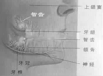 拔智齿挂什么科室 拔智齿到医院挂什么科？