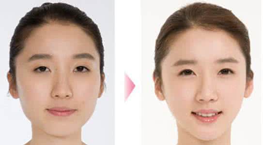 悬针纹 男女叁阳起卧蚕 莹然光彩好儿郎 悬针理乱来侵位 宿债平生不可当